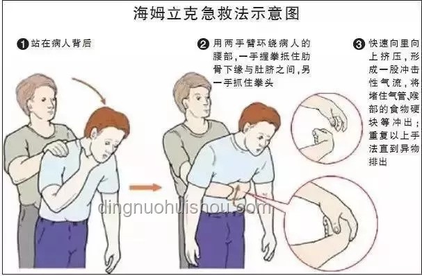 **不小心滑倒后的自救与装逼技巧：乌龙绞柱动作解析与防范策略**